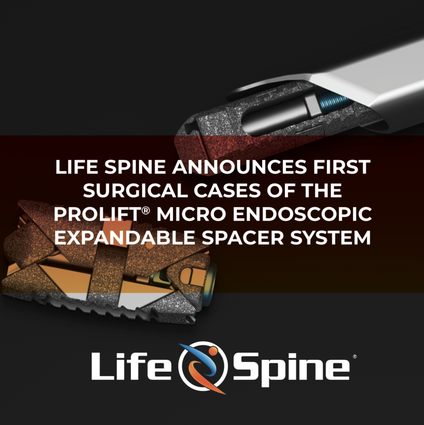 LIFE SPINE ANNOUNCES FIRST SURGICAL CASES OF THE PROLIFT® MICRO ENDOSCOPIC EXPANDABLE SPACER SYSTEM