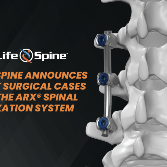 LIFE SPINE ANNOUNCES FIRST SURGICAL CASES OF THE ARX® SPINAL FIXATION SYSTEM.